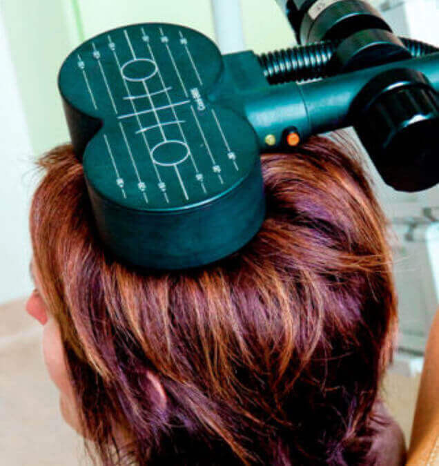 Repetitive Transcranial Magnetic Stimulation